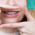 Bild zu Welche Zusatzversicherungen gibt es für Zahnbehandlungen, die nicht von der Grundversicherung abgedeckt sind?