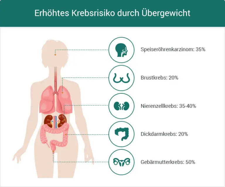 Welche Optionen zur Behandlung von Übergewicht und Adipositas gibt es in der Schweiz?