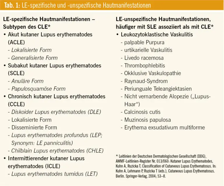 Wie funktioniert die Behandlung von Autoimmunerkrankungen wie Lupus in der Schweiz?