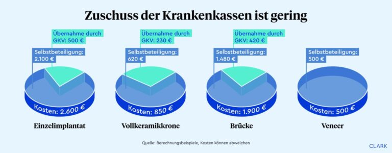 Wie funktioniert die Krankenzusatzversicherung in der Schweiz?